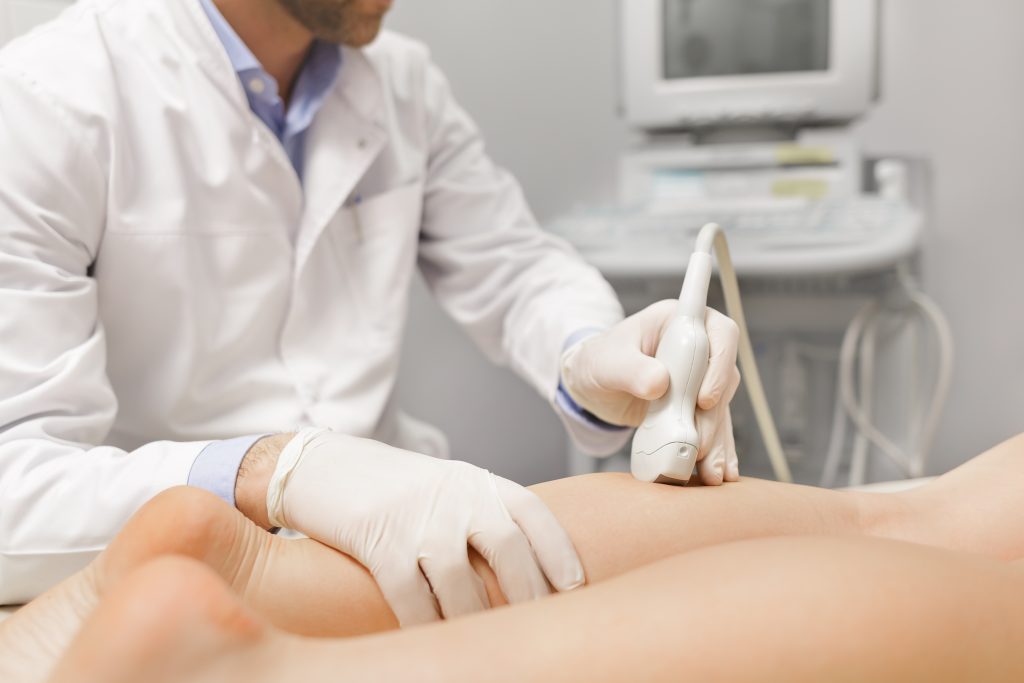 Chirurgia vascolare e vene varicose