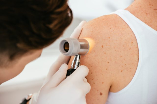 Cropped,View,Of,Dermatologist,In,Latex,Gloves,Holding,Dermatoscope,While